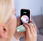 Charger l&#39;image dans la galerie, Détartreur dentaire visuel
